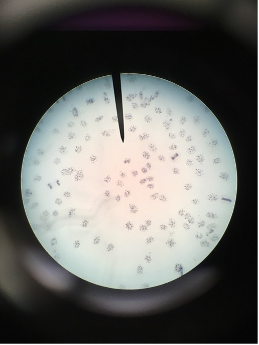 
							
								A microscope field with many cells visible. The cells have an abundance of very small speckles in an unstained nucleus. 
							
							